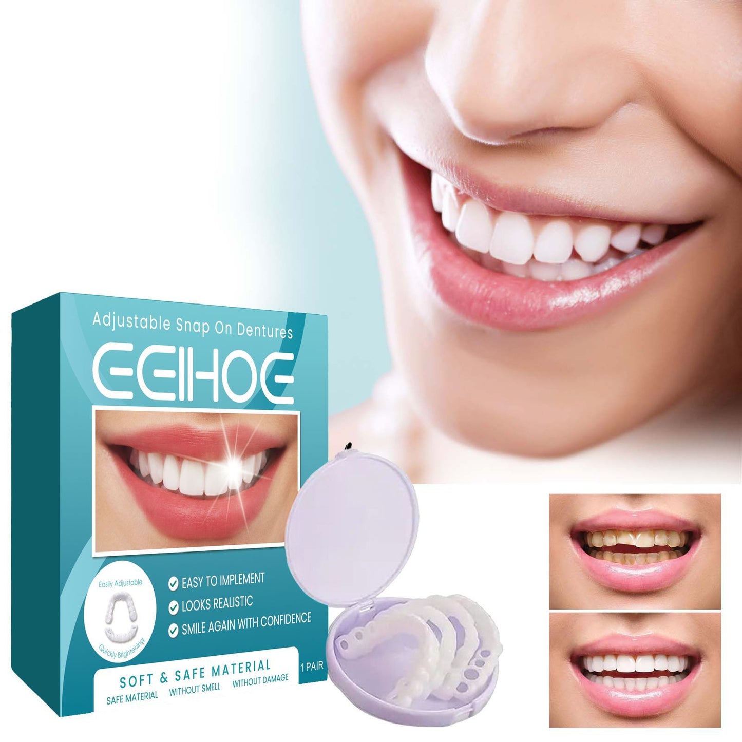EELHOE Adjustable Snap On Dentures Temporary Gap Filling Orthodontic Dentures Kit