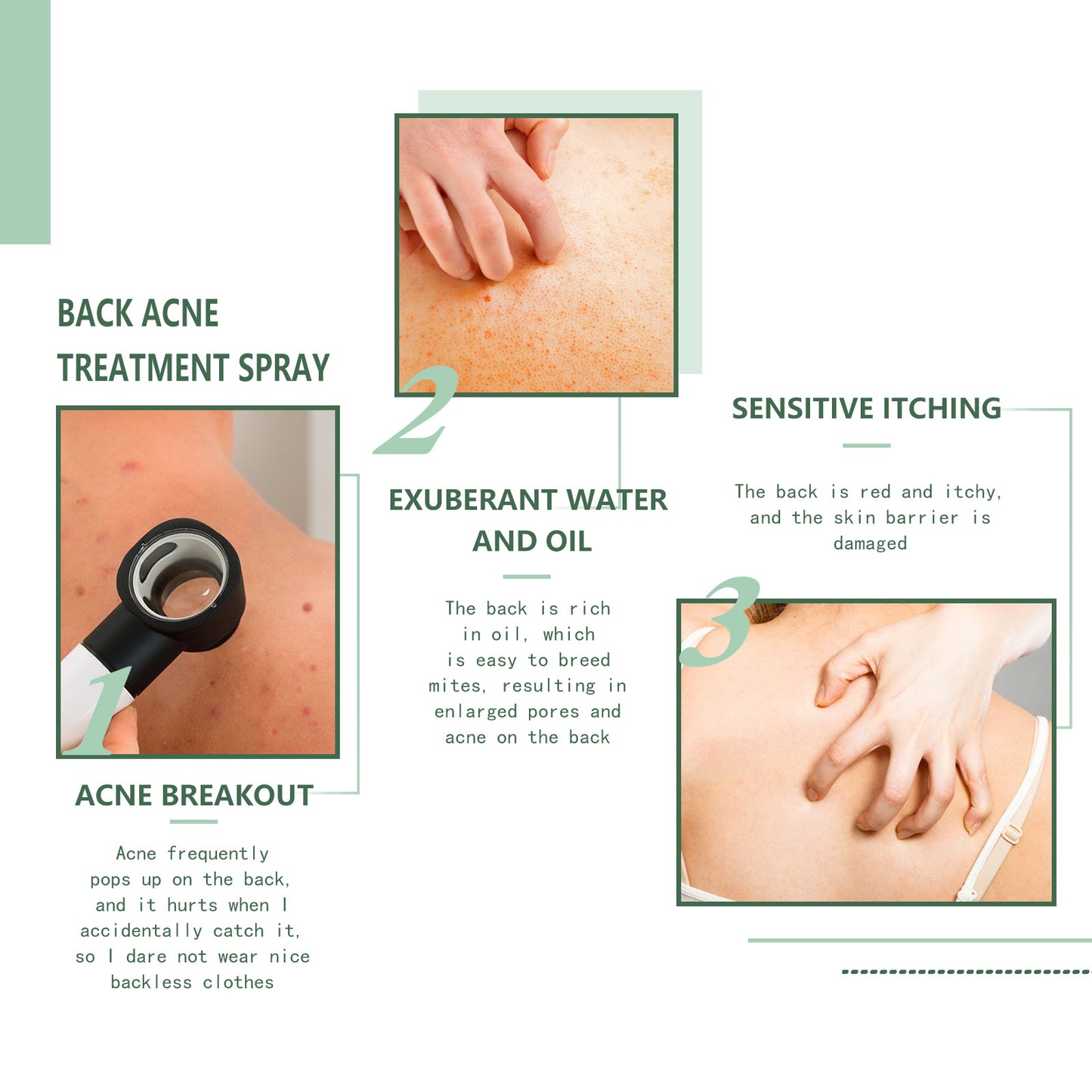 Jaysuing Back Acne Repair Spray, Repair Body Acne Fade Acne Mark Skin Care Spray
