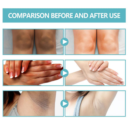 EELHOE Black Echinacea Repair Cream Repair Underarms Arms Knees Joints Dark Moisturizing Whitening Body Cream