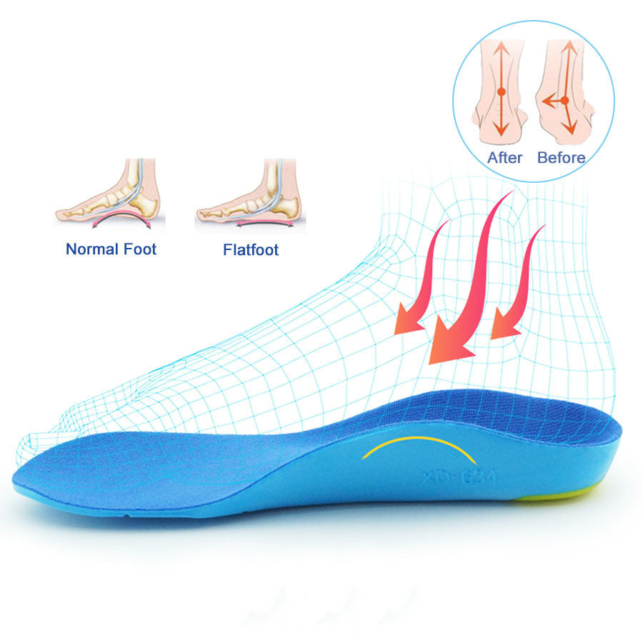 Children's Insoles O/X Leg Foot Valgus Arch Support Orthosis Flat Foot Correction Insole Foot Care