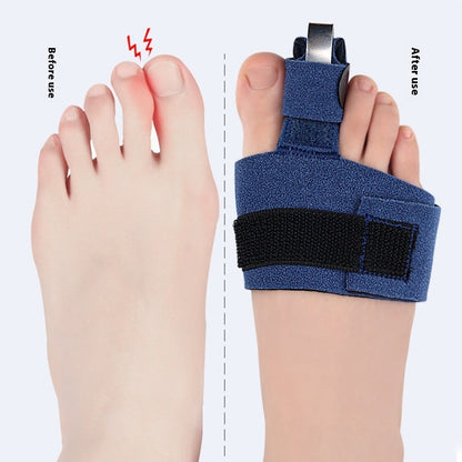 Toe Fixing Band Adjustable Fixed Splint Single Finger Curved Bow Aluminum Plate Support Protective Gear Toe Protective Cover